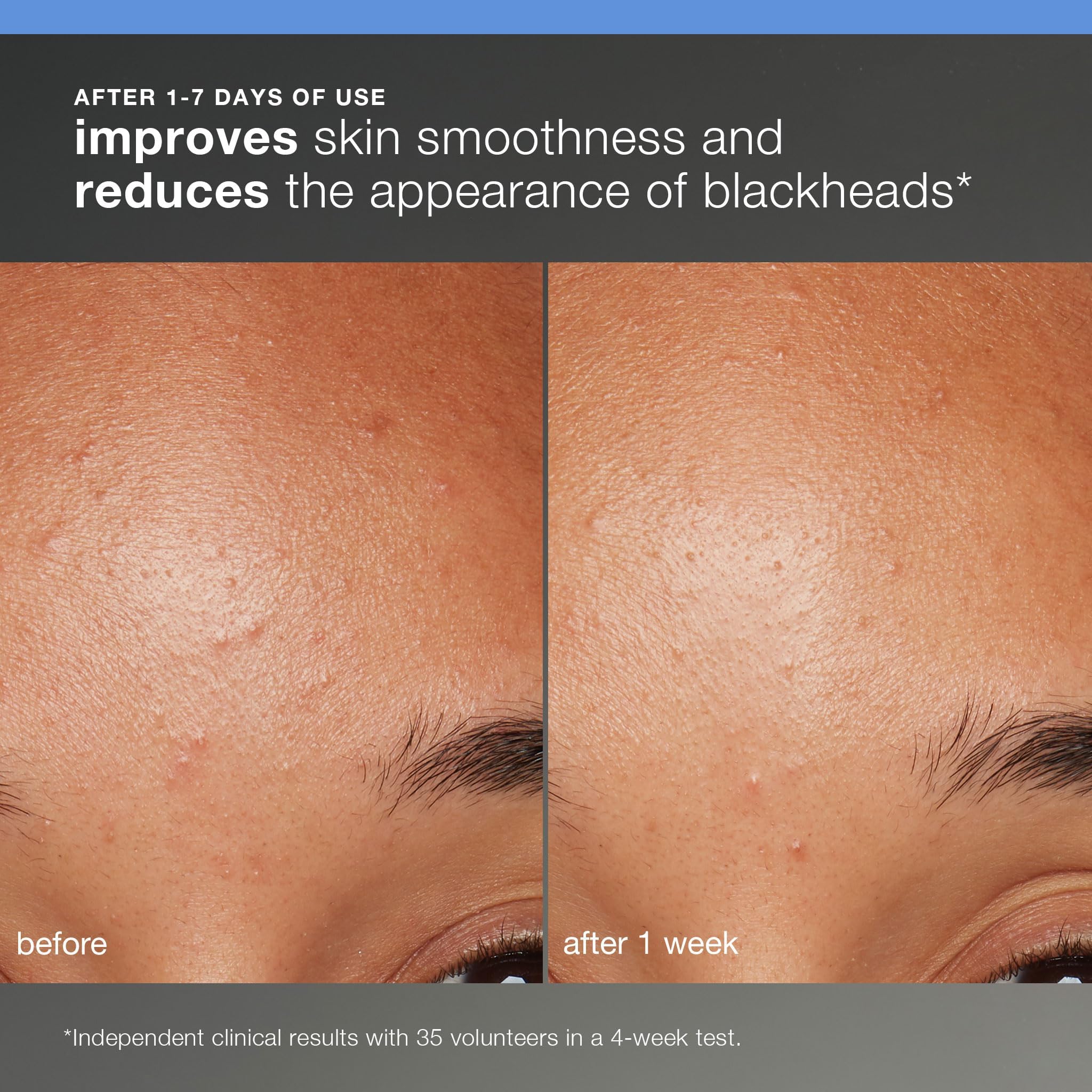 Dermalogica Discover Healthy Skin Kit - Includes: Precleanse, Face Wash, Face Exfoliator, & Moisturizer - Wash Away Impurities To Reveal Glowing Skin